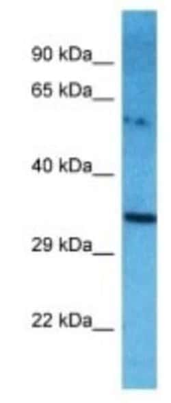 TXNDC6 Rabbit anti-Human, Polyclonal, Novus Biologicals 100 &mu;g | Buy Online | Novus Biologicals | Fisher Scientific